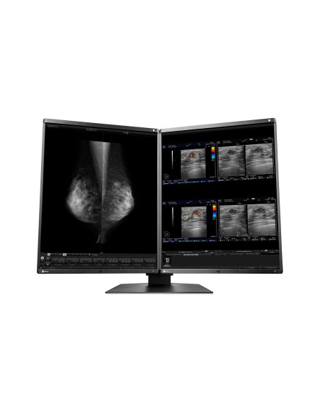 EIZO RadiForce RX560-MD Monitor PC 54,1 cm (21.3") 2048 x 2560 Pixel LCD Nero