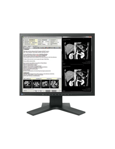 EIZO RadiForce MX194 48,3 cm (19") 1280 x 1024 Pixel LCD Nero