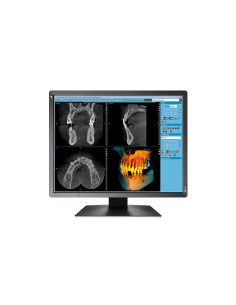 EIZO RadiForce MX216-SB LED display 53,3 cm (21") 1200 x 1600 Pixel Nero