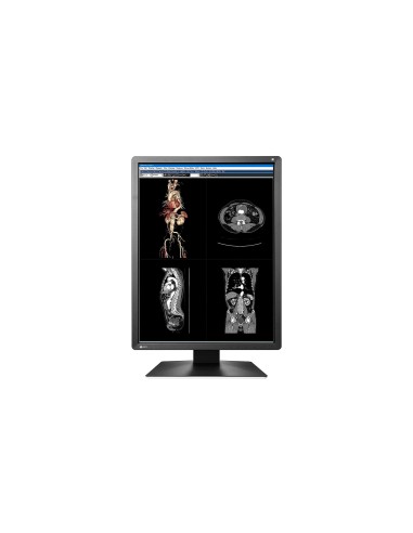 EIZO RadiForce MX216-SB LED display 53,3 cm (21") 1200 x 1600 Pixel Nero