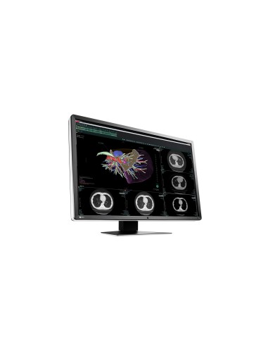 EIZO RadiForce RX660 76,2 cm (30") 3280 x 2048 Pixel WQSXGA LED Nero, Bianco