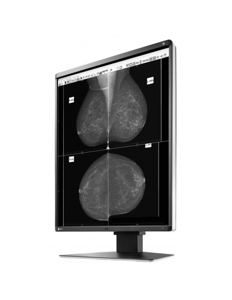 EIZO RadiForce GX560 Monitor PC 54,1 cm (21.3") 2048 x 2560 Pixel LCD Nero
