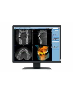 EIZO RadiForce MX217-SB Monitor PC 53,3 cm (21") 1200 x 1600 Pixel UXGA LCD Nero
