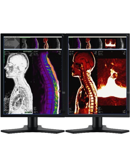NEC MD212MC 21.3" LCD Display Monitor PC 54,1 cm (21.3") 1200 x 1600 Pixel Nero