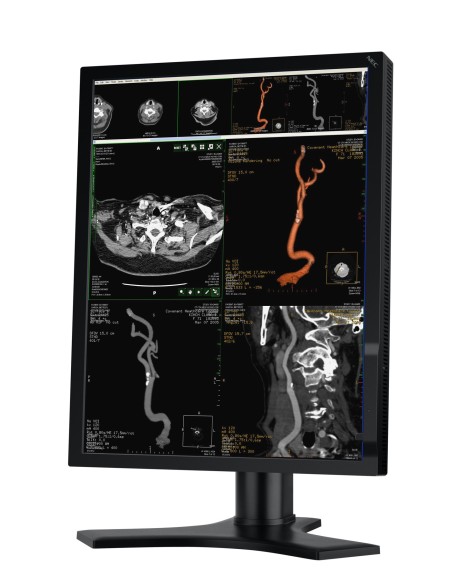 NEC MD213MC Monitor PC 54,1 cm (21.3") 2048 x 1536 Pixel Full HD Nero