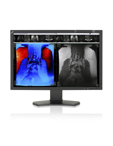 NEC MultiSync MD242C2 LED display 61 cm (24") 1920 x 1200 Pixel Full HD Nero