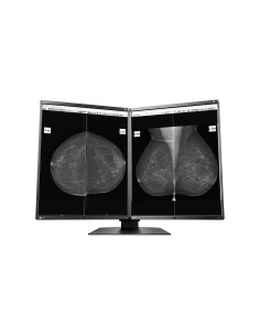 EIZO RadiForce GX560-MD 54,1 cm (21.3") 2048 x 2560 Pixel LCD Nero