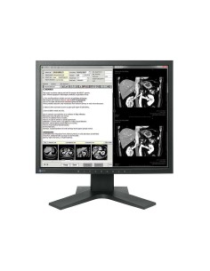 EIZO RadiForce MX194 48,3 cm (19") 1280 x 1024 Pixel LCD Nero