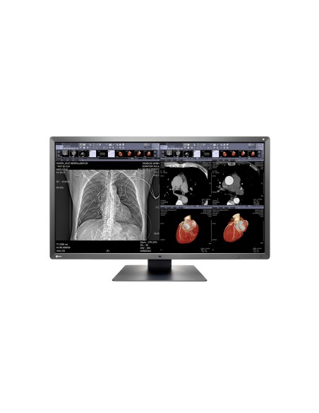 EIZO RadiForce MX315W LED display 79 cm (31.1") 4096 x 2160 Pixel 4K Ultra HD Nero