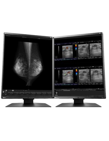 EIZO RadiForce RX560 Monitor PC 54,1 cm (21.3") 2048 x 2560 Pixel LCD Nero