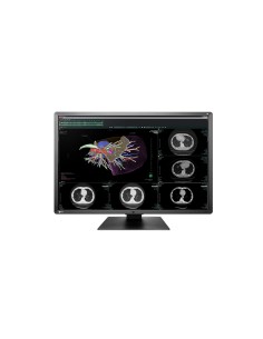 EIZO RadiForce RX660 76,2 cm (30") 3280 x 2048 Pixel WQSXGA LED Nero, Bianco